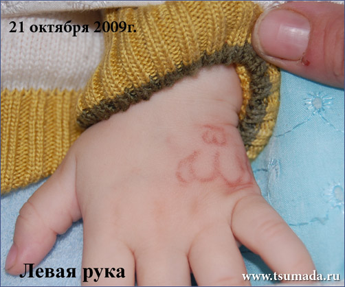 На руке ребенка по имени Али из с.Красно-Октябрьское Кизлярского района появилась надпись на арабском «Аллах»,  На руке ребенка по имени Али из с.Красно-Октябрьское Кизлярского района появилась надпись на арабском «Аллах»